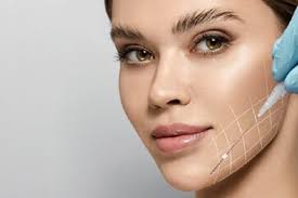 Define Your Jawline with PDO Thread Jawline Lift at S2G Medical Spa
