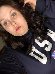 You Know Someone That Loves To Pimple Pop?! 💥💥💥