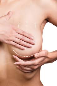 Maybe you would like to learn more about one of these? Scarless Breast Lift Surgery San Diego Best Breast Lift Surgeon