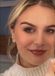 ⭐️✨World Kidney Day is here..and for today's story…we have Emma Kearns✨⭐️  My name is Emma Kearns. I'm now 25, but in March 2023 when I was 24, it was  discovered that I