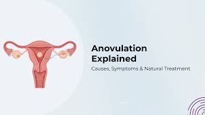 Image result for Anovulation