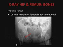 Branches of the internal iliac artery. Nursing X Ray Interpretation Part 2 Pelvis And Hip Alexander Street A Proquest Company