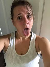 Is it normal to get red blotchy face after intense workouts?