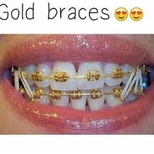 Trey A Look Nice With These Treytraylor Next Time You Go To The Dentist To Get Your Color Changed Get This Gold Braces Cute Braces Colors Braces Colors