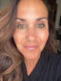 I have not been good about taking care of my skin. Grateful for this  ￼Liquid gold! Stem cell, PRP facial! First picture is right after I had it  done, the other photo