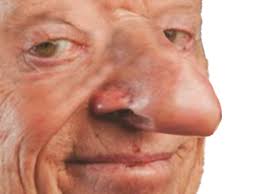 Sticker de HindiNaroy sur chance risitas larry silverstein pif nez