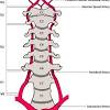 Carotid artery disease is a disease in which a waxy substance called plaque builds up inside the carotid arteries. 1
