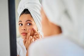 почему у одних есть прыщи а у других нет Ekspertnoe Mnenie Pochemu Vasha Kozha Sklonna K Akne Spletnik