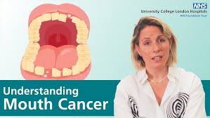 Image result for dental cancer