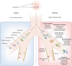 Unsaturated fats have fewer hydrogen atoms than saturated fats (so named because the carbon atoms aren't saturated with hydrogen atoms). The Influence Of The Microbiome On Respiratory Health Nature Immunology