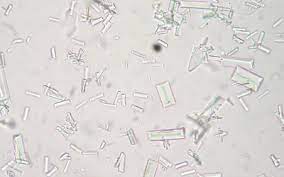 Struvite Bladder Stones In Dogs Vca Animal Hospital