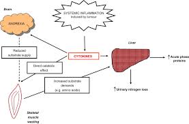 Image result for Cachexia in Cancer