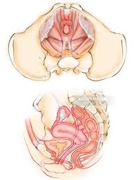 The levator ani muscles are the largest group of muscles in the pelvis. Female Pelvic Floor Muscles Illustration By Juliet Percival Medical