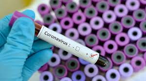 Get full coverage of the coronavirus pandemic including the latest news, analysis, advice and explainers from across the uk and around the world. Fragen Und Antworten Zum Coronavirus