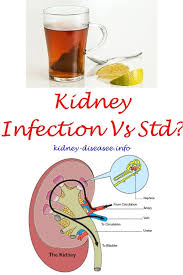 Best Kidney Cleanse Polycystic Kidney Disease Kidney Disease Recipes Kidney Disease Symptoms