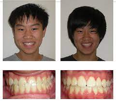 We did not find results for: Before And After Bellevue Wa Dentist