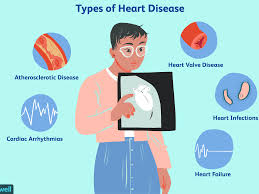 Heart Disease Treatments