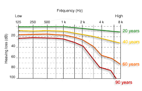 29 Perspicuous Hearing Age Chart