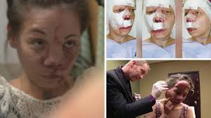 Mum with deadly condition is given a new chance at life