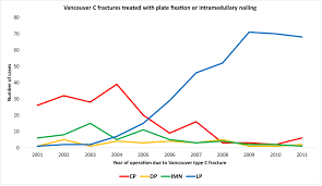 Learn all about the history of vancouver, see how it started out and find out more about historic locations, fun facts and other stories relating to the area. Lower Reoperation Rate With Locking Plates Compared With Conventional Plates In Vancouver Type C Periprosthetic Femoral Fractures A Register Study Of 639 Cases In Sweden Injury