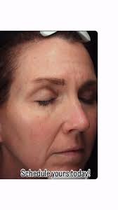 Phyllis Clare RN, BSN (@phoebeglow_aesthetics) • Instagram photos and videos