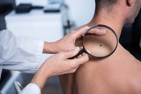 A persistent cough could be a symptom of lung cancer or head any significant change in bowel habits that cannot be easily explained by dietary changes could be. Signs Of Cancer Men Are Likely To Ignore The Healthy