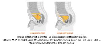 Image result for Genitourinary Trauma