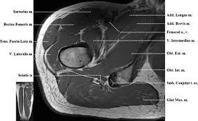 Almost every muscle constitutes one part of a pair of identical bilateral. Normal Mr Imaging Anatomy Of The Thigh And Leg Magnetic Resonance Imaging Clinics