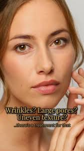 Wishing you a Friday as smooth as your forehead! 💉 #medspa #aesthetics  #nurseinjector #botox #medspamarketing