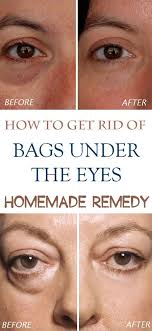 No More Wrinkles And Sagging Skin On Your Face 2 Ingredients Only Woman Tricks Undereye Beauty Remedies Under Eye Bags