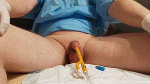 Insert the CH 30FR Catheter into the Small Penis, Small Peeling, Slowly -  Pornhub Gay