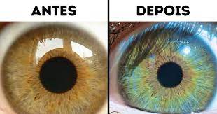7 Aspectos Que Influenciam E Podem Mudar A Cor Dos Seus Olhos Incrivel