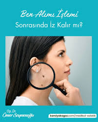 ☘️Benler, doğuştan ya da sonradan oluşabilirler. ☘️Benler, güneş ışınları  nedeni ile kötüleşebilir. Büyüyen, rengi ve şekli değişen benlerin mutlaka  alınması gereklidir. ☘️Ben alma işlemi lazerle ya da cerrahi yöntemlerle  yapılmaktadır. ☘️Hangi ...