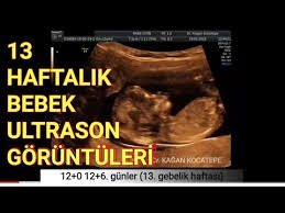13 Haftada Bebekte Hangi Ayrintilar Gorulebilir Organlar Kollar Bacaklar Cinsiyet Net Gorulur Mu Youtube