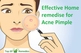 How To Get Rid Of Pimples Permanently Using Home Remedies Home Remedies For Anything How To Get Rid Of Pimples Back Acne Treatment Skin Care Pimples