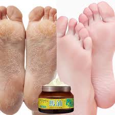 The road to el dorado has many perils, for chel, a long trek through the jungle is very hard, especially when her feet itch so bad. Buy Foot Repair Cream Moisturizing Nourishing Skin Anti Drying Anti Crack Heel Care Essential Cream At Affordable Prices Price 9 Usd Free Shipping Real Reviews With Photos Joom