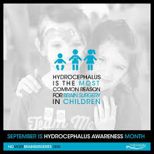Pin On Hydrocephalus