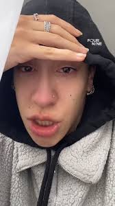 Tattoo Eyebrows Trauma