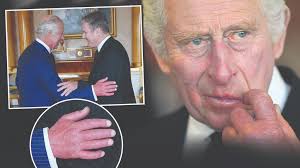 King Charles' 'sausage fingers ...