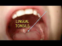 • 56 млн просмотров 1 год назад. How To Use A Tongue Scraper To Clean Your Tongue Properly Youtube