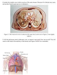 Here is a full and a plan diagram of ts of a sorghum leaf: Solved Blood Vessels In Cross Section Recall The Structur Chegg Com