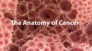 Maybe you would like to learn more about one of these? What Is Cancer What Causes Cancer And How Is It Treated Youtube