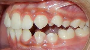 We did not find results for: Is Smile Direct Club Safe Even28 Dentist Search Engine