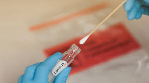 The collection of samples happen only by prescription from a qualified physician. Entenda Quais Sao Os Diferentes Tipos De Teste Para A Covid 19
