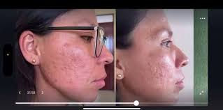 RIMAN Distribuidor Cd. Obregón