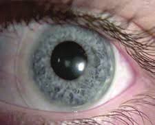 巩膜镜片验配手册