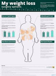 Best Weight Loss Surgery Options Chart Graph Infographics
