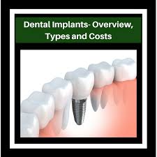 Affordable Dental Care Manhattan Tooth Implant Cost Affordable Dental Implants Low Cost Dental Implants