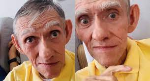 Mandíbula', humorista de Sábados Felices, sigue recibiendo sueldo por parte  de Caracol