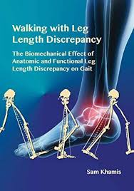 Image result for Functional Leg Length Discrepancy